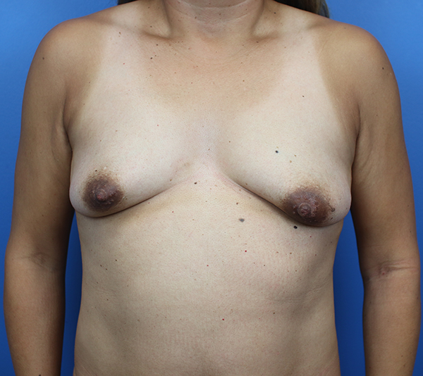 Breast examination on blue background, highlighting patient care and professionalism.