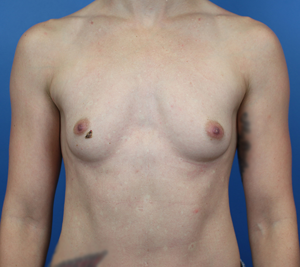 Professional medical examination of a patient’s torso against a blue backdrop.
