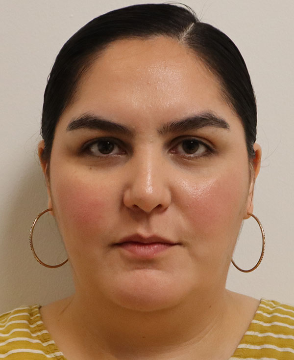 Professional portrait of Daniela Atencio, MD, with a neutral expression and striped shirt.