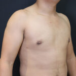 Male torso, showcasing skin health and wellness, aligned with Daniela Atencio, MD's expertise.