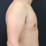 Male torso profile against a dark background, highlighting body contour.