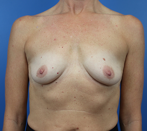 Breast examination by Daniela Atencio, MD, showcasing professional care.
