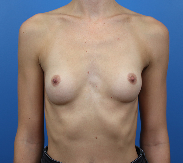 Breast examination with neutral background, emphasizing professional medical care.