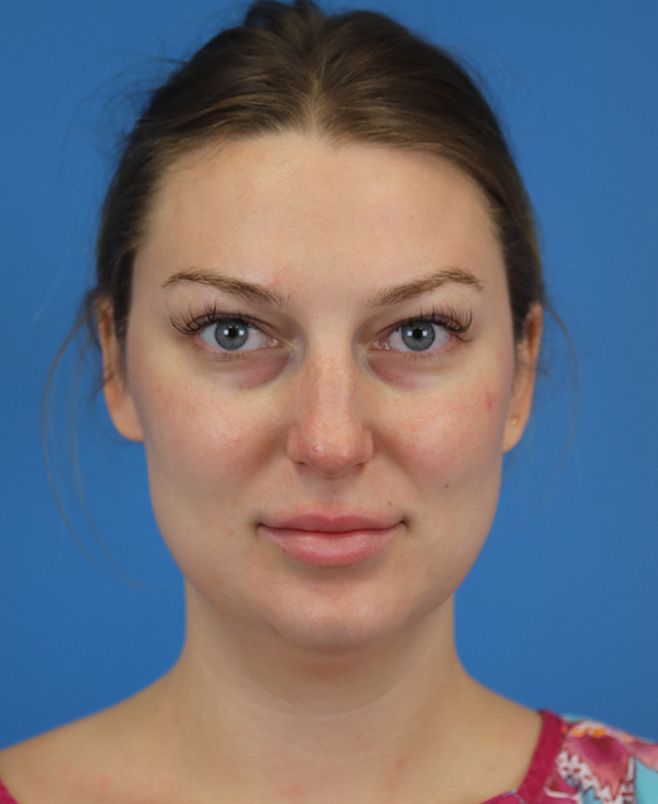 Professional portrait of a woman with natural makeup against a blue background.