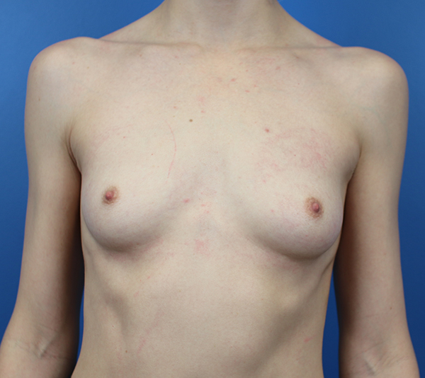 Patient torso against blue background, emphasizing medical examination context.