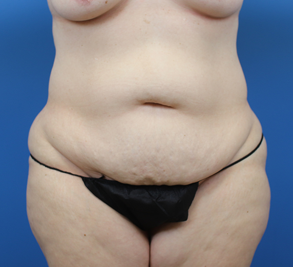 Body positivity representation with focus on diverse body shapes and sizes.