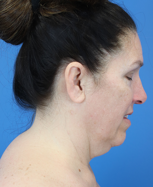 Profile view of a woman with a neutral expression against a blue background.