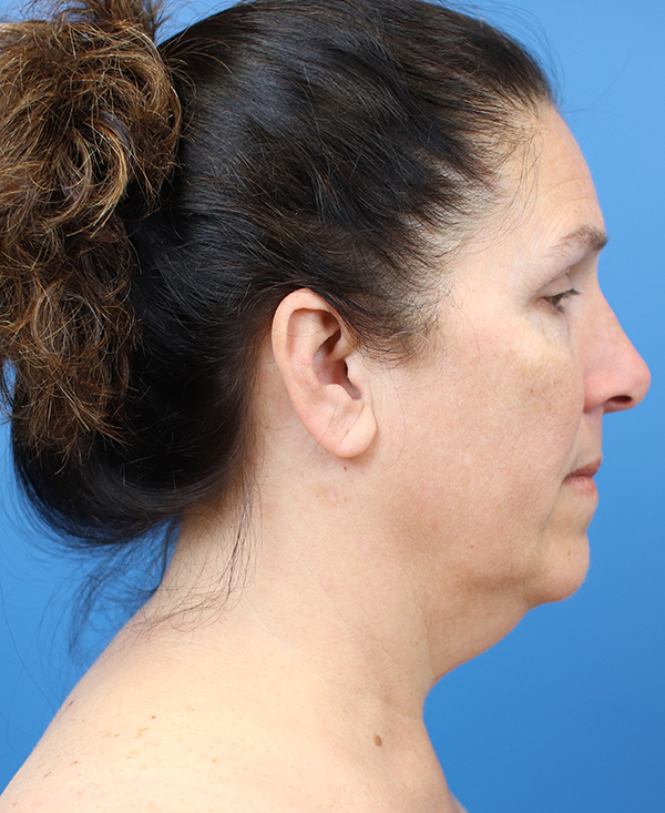 Profile view of a woman with a natural, healthy appearance against a blue background.
