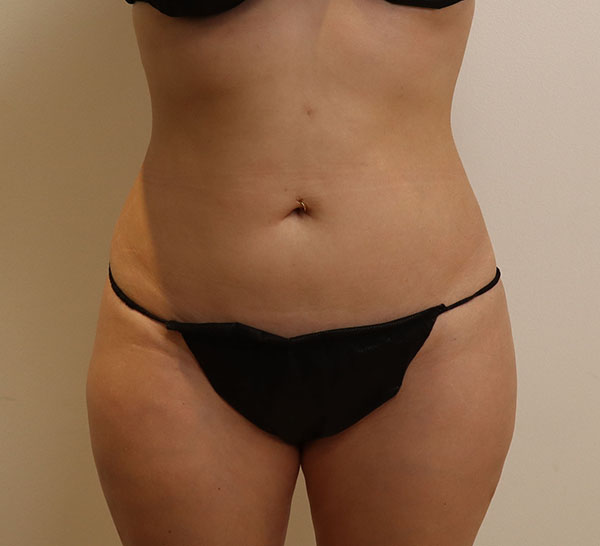Model in black swimwear, showcasing body confidence and wellness.