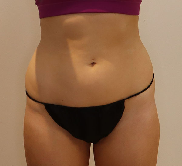 Model wearing black lingerie, showcasing body confidence and wellness.