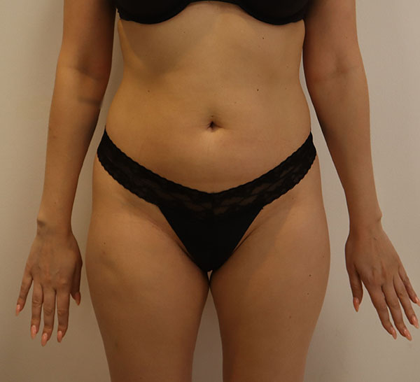 Model in black lingerie, emphasizing body positivity and confidence.