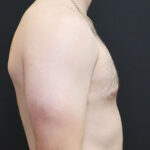 Male torso profile against a dark background, highlighting physique and health.