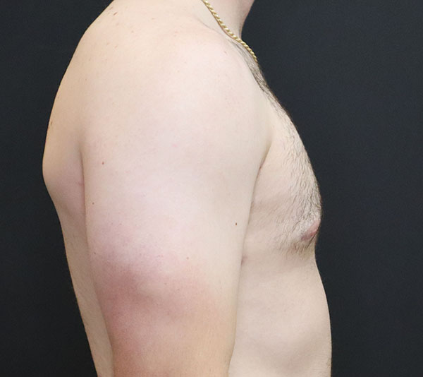 Male torso profile against a dark background, highlighting physique and health.