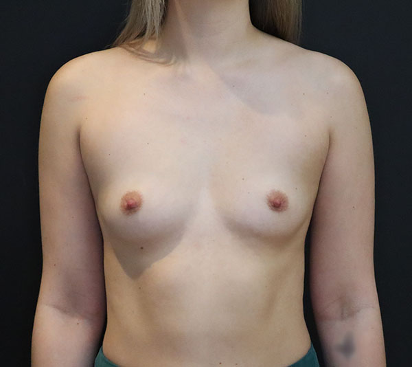 Patient consultation for breast health assessment at Daniela Atencio, MD.